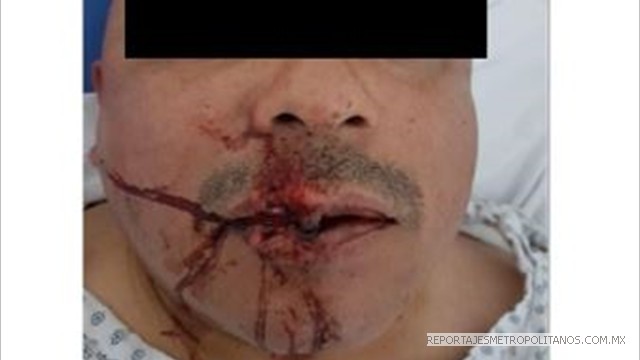 En el enfrentamiento entre policías y vecinos hubo varios lesionados 